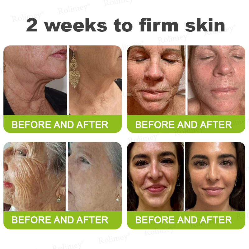 ☘️✨Made and shipped from the USA 💫Rolimey® Botox & Vita-A Retinol Shot Wrinkle-Lift Tightening cream - Last Day Promotion 70% OFF