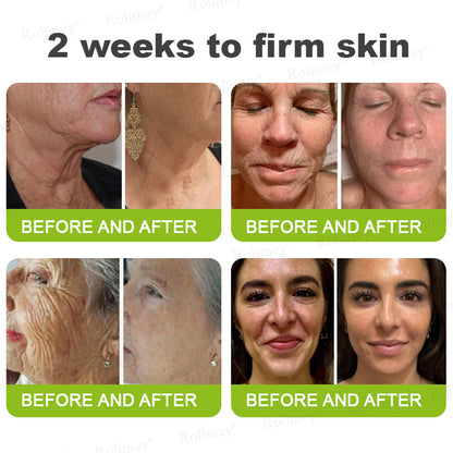 ☘️✨Made and shipped from the USA 💫Rolimey® Botox & Vita-A Retinol Shot Wrinkle-Lift Tightening cream - Last Day Promotion 70% OFF