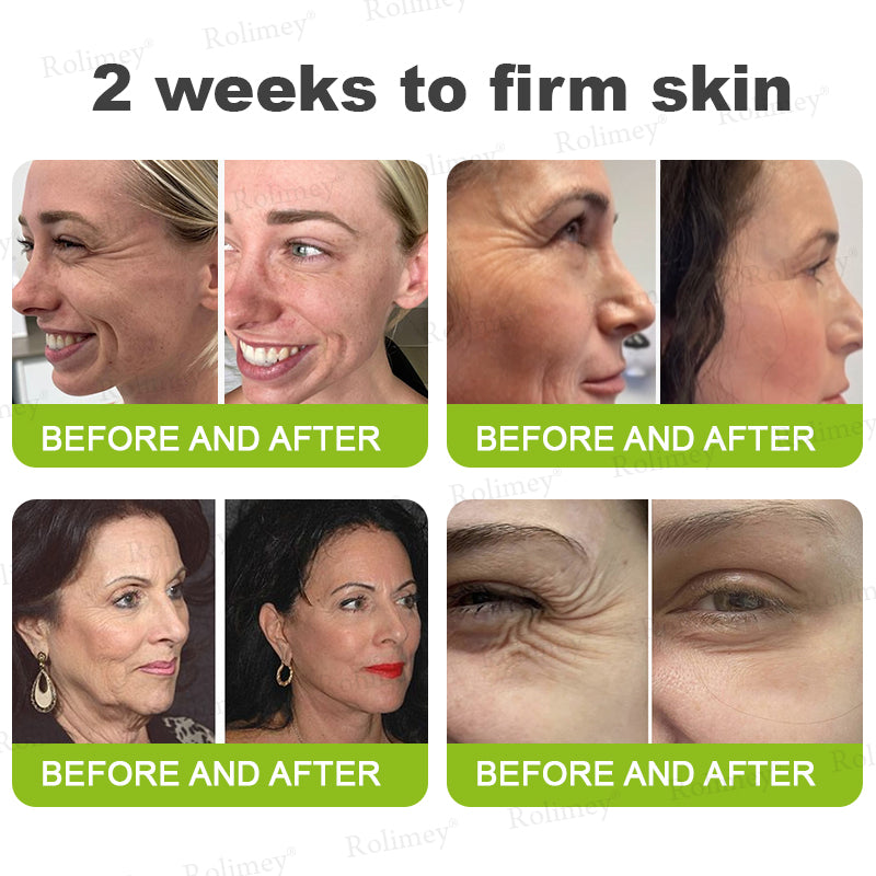 ☘️✨Made and shipped from the USA 💫Rolimey® Botox & Vita-A Retinol Shot Wrinkle-Lift Tightening cream - Last Day Promotion 70% OFF