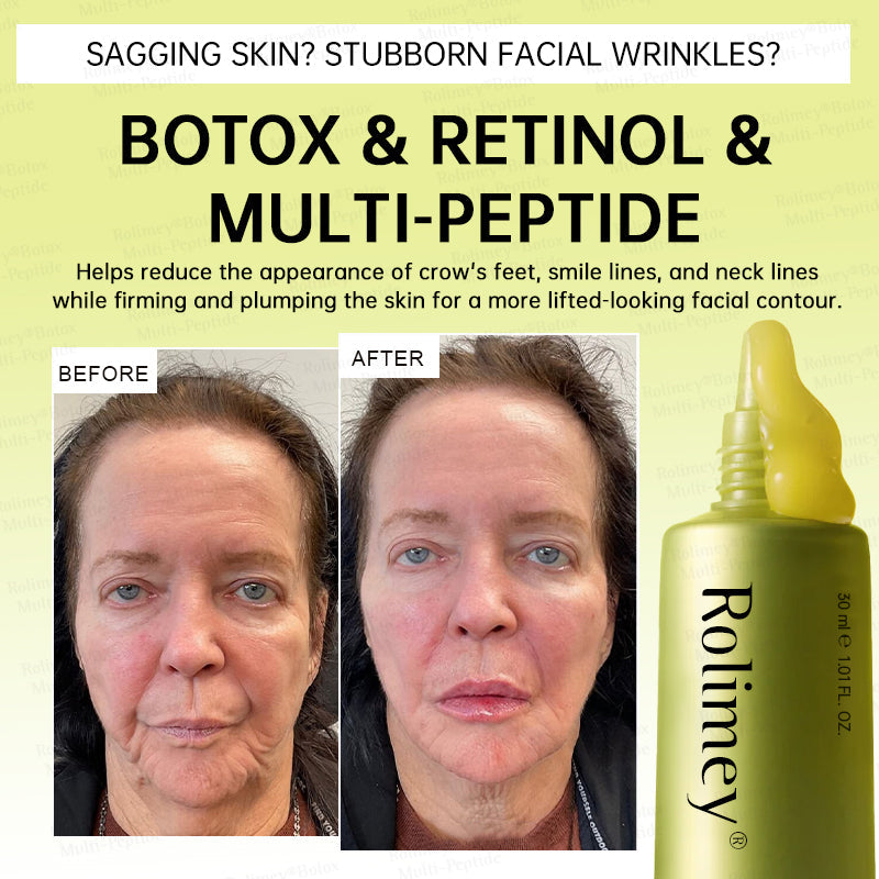 🏅USA HOT SALES🌟Rolimey® Multi-Peptide Retinol Shot Wrinkle-Lift Cream