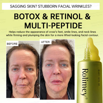 🏅USA HOT SALES🌟Rolimey® Multi-Peptide Retinol Shot Wrinkle-Lift Cream
