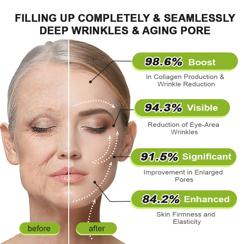 ☘️✨Made and shipped from the USA 💫Rolimey® Botox & Vita-A Retinol Shot Wrinkle-Lift Tightening cream - Last Day Promotion 70% OFF