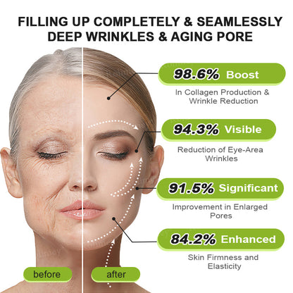 ☘️✨Made and shipped from the USA 💫Rolimey® Botox & Vita-A Retinol Shot Wrinkle-Lift Tightening cream - Last Day Promotion 70% OFF