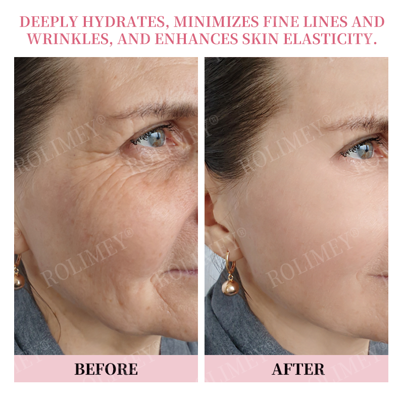 👨‍⚕️🛡️Made and Shipped from USA✅Rolimey®Botox & Stem Cell Firming Anti-Wrinkle Cream Last Day 70% OFF!
