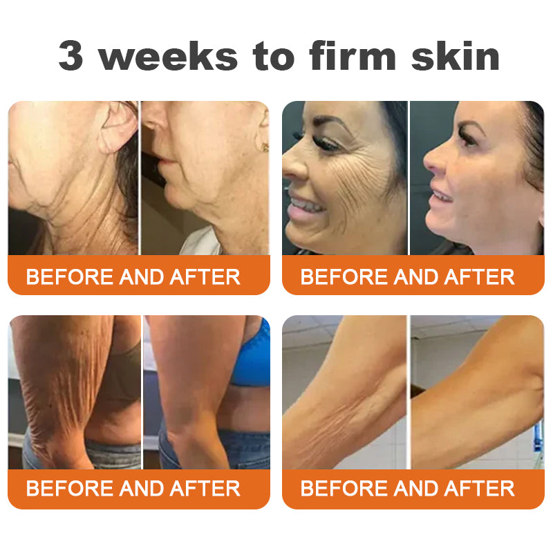 💐✅Made and Shipped from the USA✨Flysmus™ Botox Bee Venom Firming Serum Stick🔥LAST DAY 70% OFF