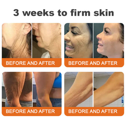 💐✅Made and Shipped from the USA✨Flysmus™ Botox Bee Venom Firming Serum Stick🔥LAST DAY 70% OFF