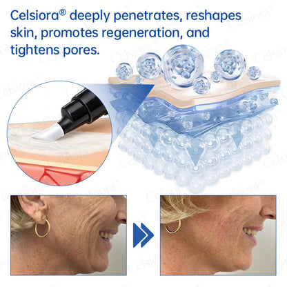 🔥👨‍⚕️USA HOT SALES💫Celsiora® Botox & PDRN Anti-Wrinkle Shot – Lift & Firming Cream