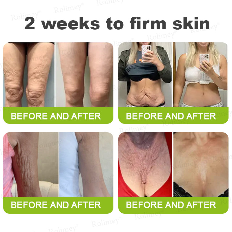 ☘️✨Made and shipped from the USA 💫Rolimey® Botox & Vita-A Retinol Shot Wrinkle-Lift Tightening cream - Last Day Promotion 70% OFF