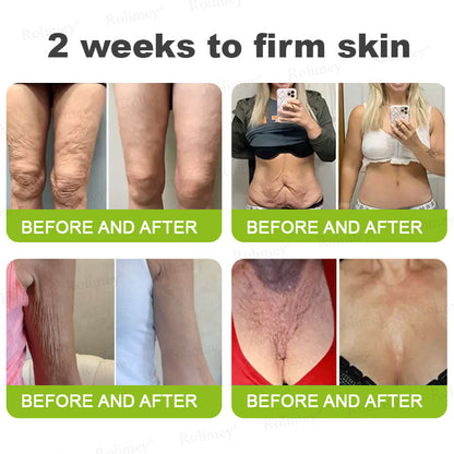 ☘️✨Made and shipped from the USA 💫Rolimey® Botox & Vita-A Retinol Shot Wrinkle-Lift Tightening cream - Last Day Promotion 70% OFF
