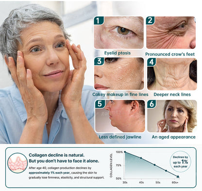 ✅USA HOT SALES ✨Rolimey® Botox & Stem Cell Wrinkle-Lift Tightening Cream
