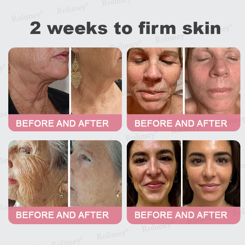 FDA Official✨Celsiora® PDRN Pink Collagen Volume Multi Balm👩‍🔬LAST DAY 70% OFF