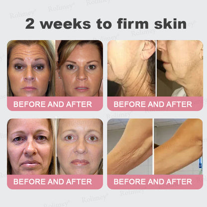 FDA Official✨Celsiora® PDRN Pink Collagen Volume Multi Balm👩‍🔬LAST DAY 70% OFF