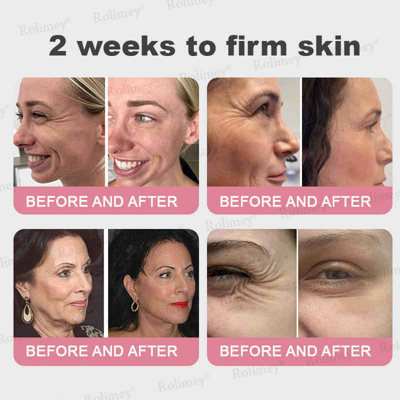 FDA Official✨Celsiora® PDRN Pink Collagen Volume Multi Balm👩‍🔬LAST DAY 70% OFF