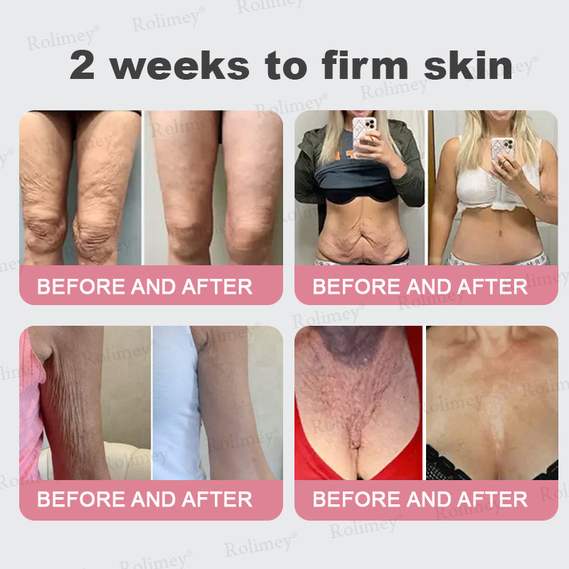 FDA Official✨Celsiora® PDRN Pink Collagen Volume Multi Balm👩‍🔬LAST DAY 70% OFF