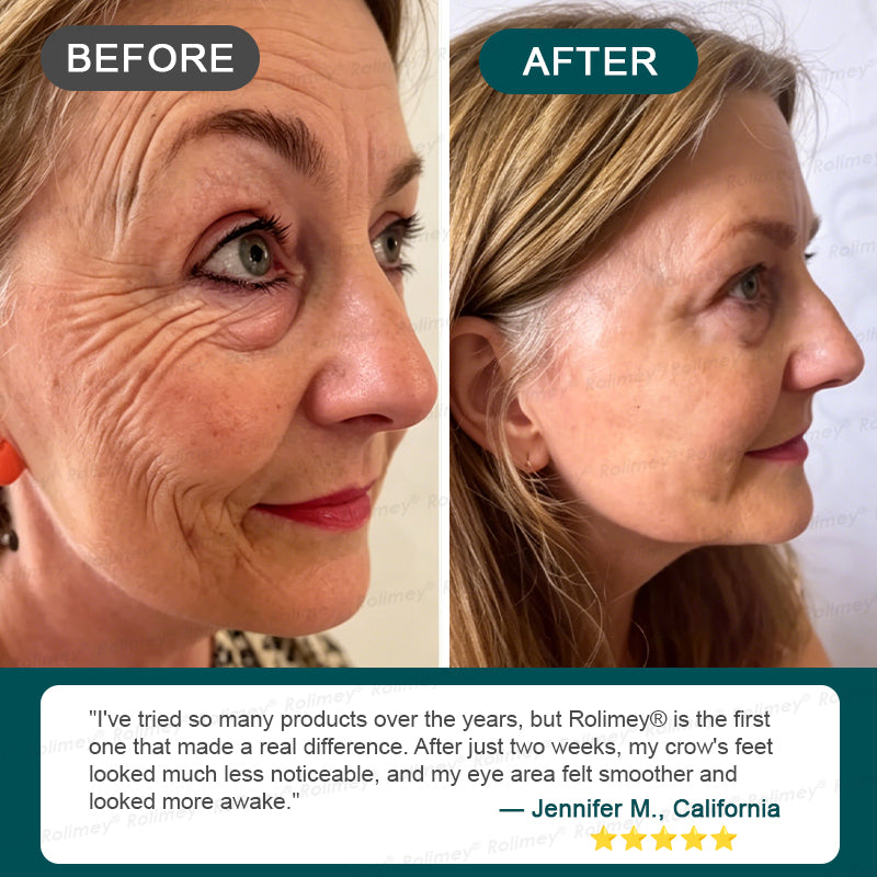✅USA HOT SALES ✨Rolimey® Botox & Stem Cell Wrinkle-Lift Tightening Cream