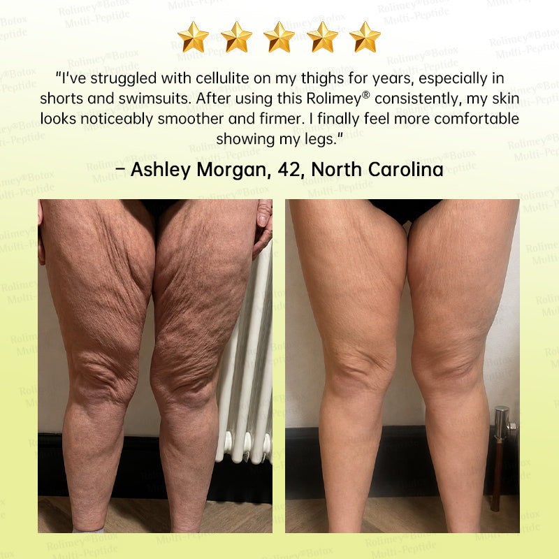 🏅USA HOT SALES🌟Rolimey® Multi-Peptide Retinol Shot Wrinkle-Lift Cream