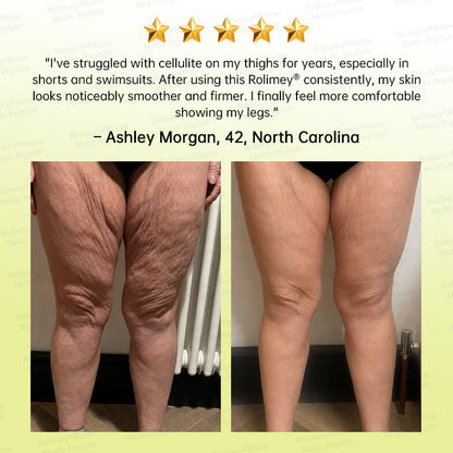 🏅USA HOT SALES🌟Rolimey® Multi-Peptide Retinol Shot Wrinkle-Lift Cream