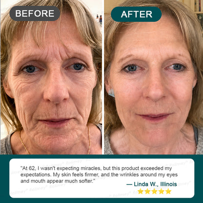 ✅USA HOT SALES ✨Rolimey® Botox & Stem Cell Wrinkle-Lift Tightening Cream