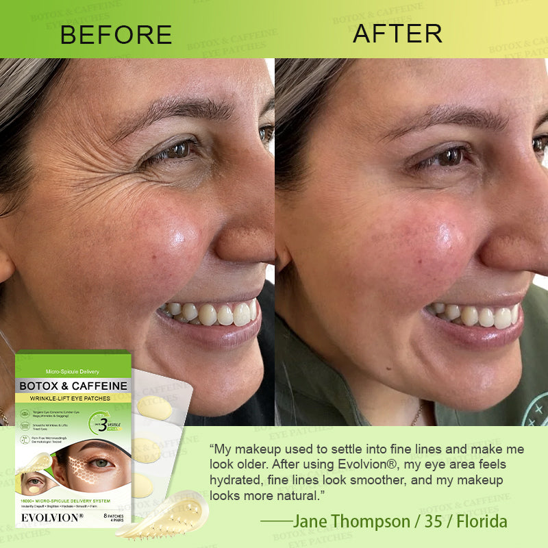 💗💗USA HOT SALES ✨Evolvion® Botox & Caffeine Wrinkle-Lift Eye Patches