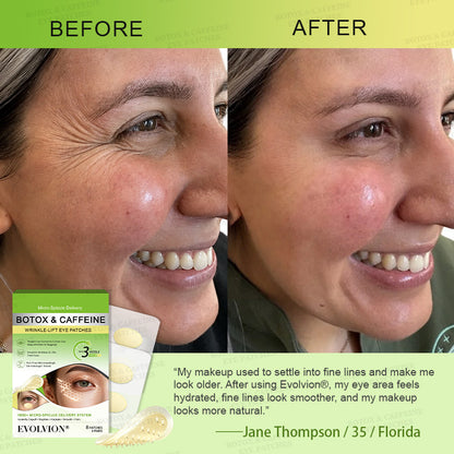 💗💗USA HOT SALES ✨Evolvion® Botox & Caffeine Wrinkle-Lift Eye Patches