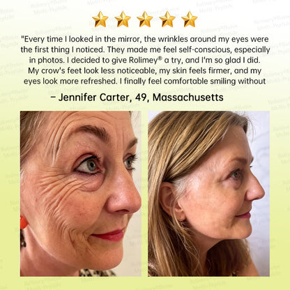 🏅USA HOT SALES🌟Rolimey® Multi-Peptide Retinol Shot Wrinkle-Lift Cream