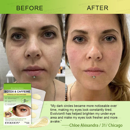 💗💗USA HOT SALES ✨Evolvion® Botox & Caffeine Wrinkle-Lift Eye Patches