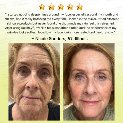 🏅USA HOT SALES🌟Rolimey® Multi-Peptide Retinol Shot Wrinkle-Lift Cream