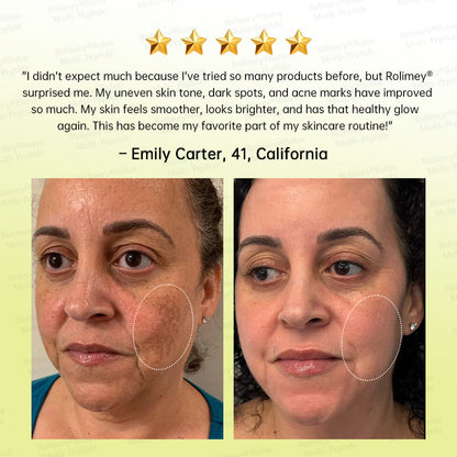 🏅USA HOT SALES🌟Rolimey® Multi-Peptide Retinol Shot Wrinkle-Lift Cream