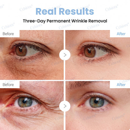 🔥👨‍⚕️USA HOT SALES💫Celsiora® Botox & PDRN Anti-Wrinkle Shot – Lift & Firming Cream