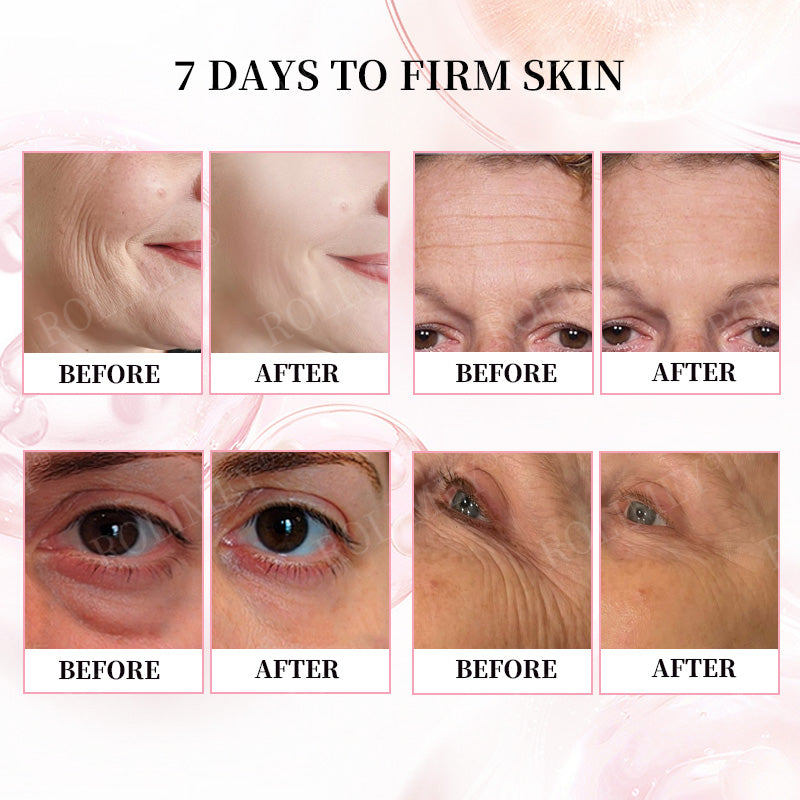 👨‍⚕️🛡️Made and Shipped from USA✅Rolimey®Botox & Stem Cell Firming Anti-Wrinkle Cream Last Day 70% OFF!