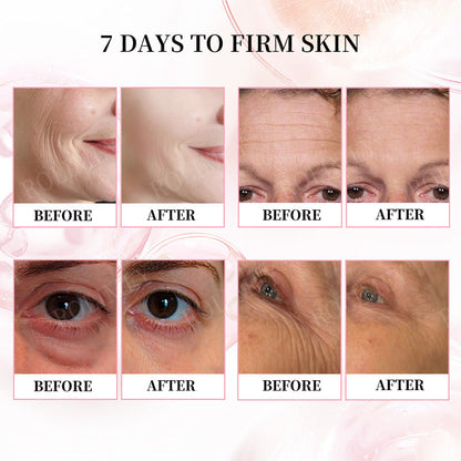 👨‍⚕️🛡️Made and Shipped from USA✅Rolimey®Botox & Stem Cell Firming Anti-Wrinkle Cream Last Day 70% OFF!