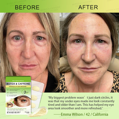 💗💗USA HOT SALES ✨Evolvion® Botox & Caffeine Wrinkle-Lift Eye Patches