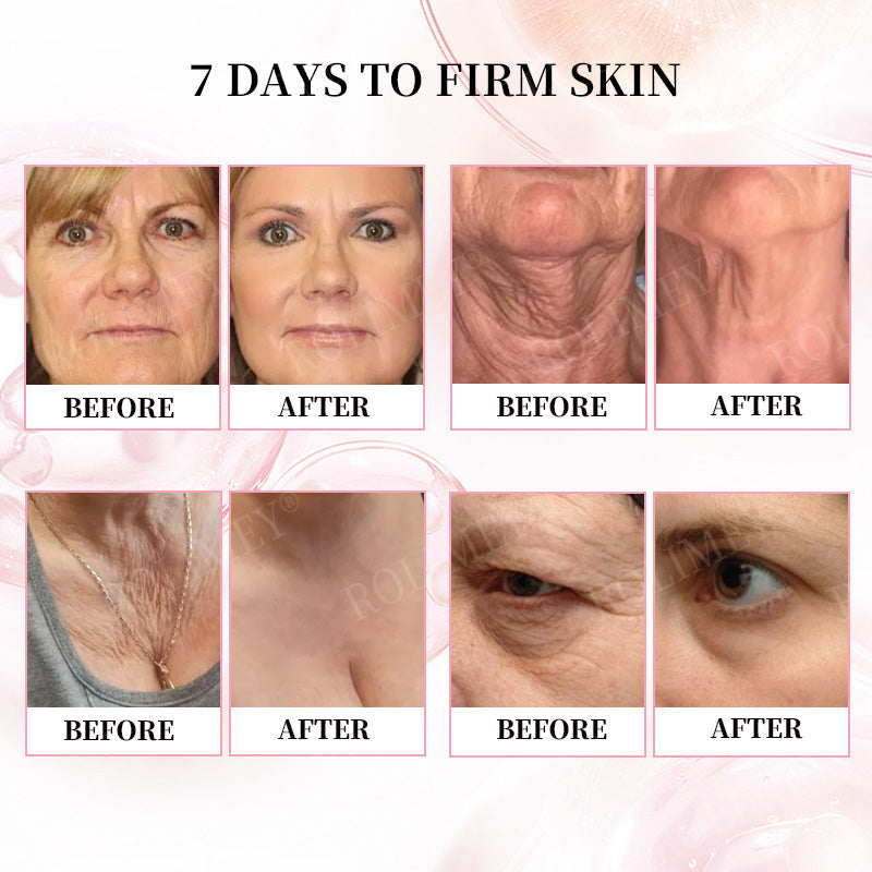 👨‍⚕️🛡️Made and Shipped from USA✅Rolimey®Botox & Stem Cell Firming Anti-Wrinkle Cream Last Day 70% OFF!