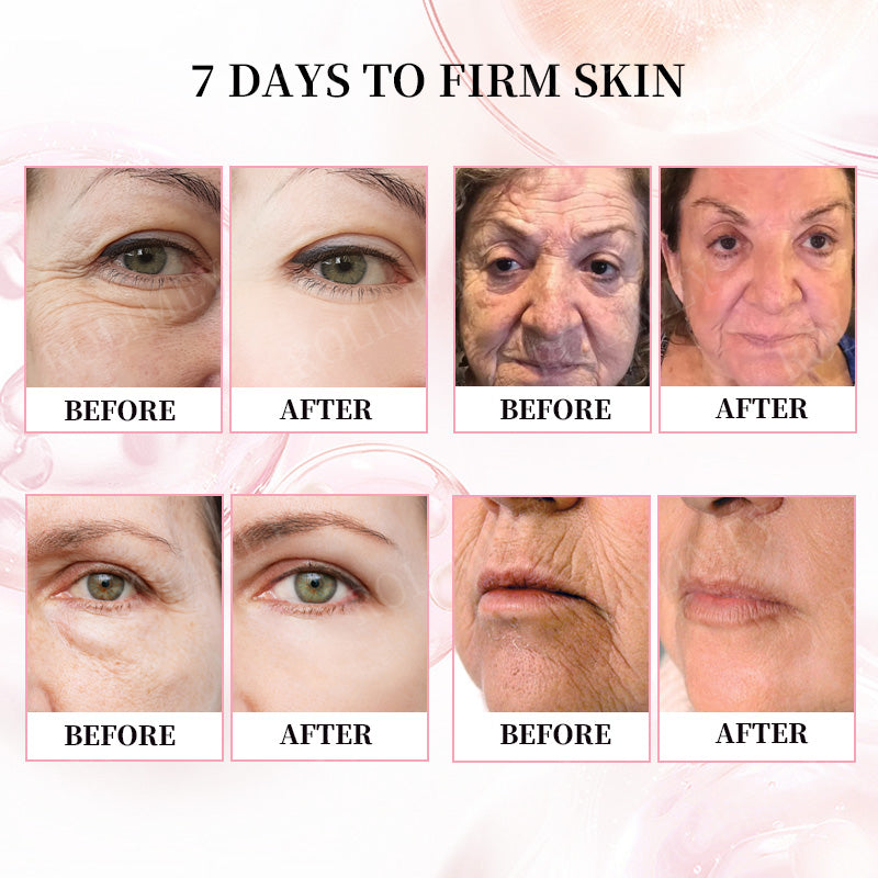 👨‍⚕️🛡️Made and Shipped from USA✅Rolimey®Botox & Stem Cell Firming Anti-Wrinkle Cream Last Day 70% OFF!
