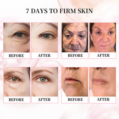 👨‍⚕️🛡️Made and Shipped from USA✅Rolimey®Botox & Stem Cell Firming Anti-Wrinkle Cream Last Day 70% OFF!