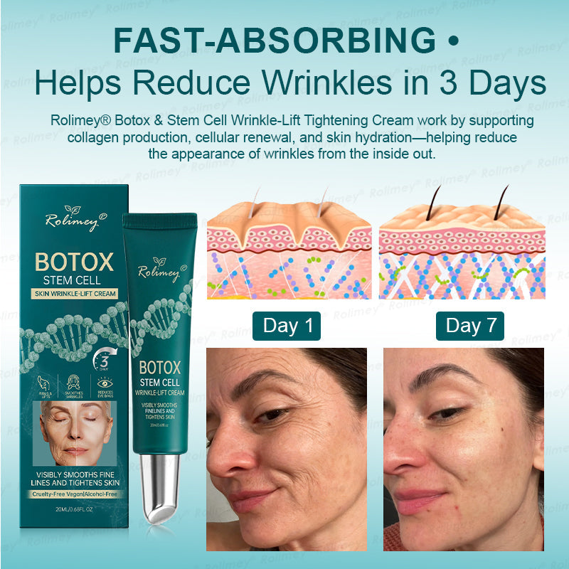 ✅USA HOT SALES ✨Rolimey® Botox & Stem Cell Wrinkle-Lift Tightening Cream