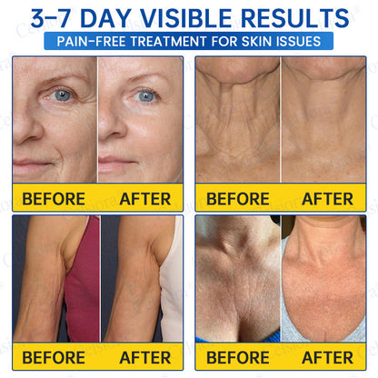 🔥👨‍⚕️USA HOT SALES💫Celsiora® Botox & PDRN Anti-Wrinkle Shot – Lift & Firming Cream