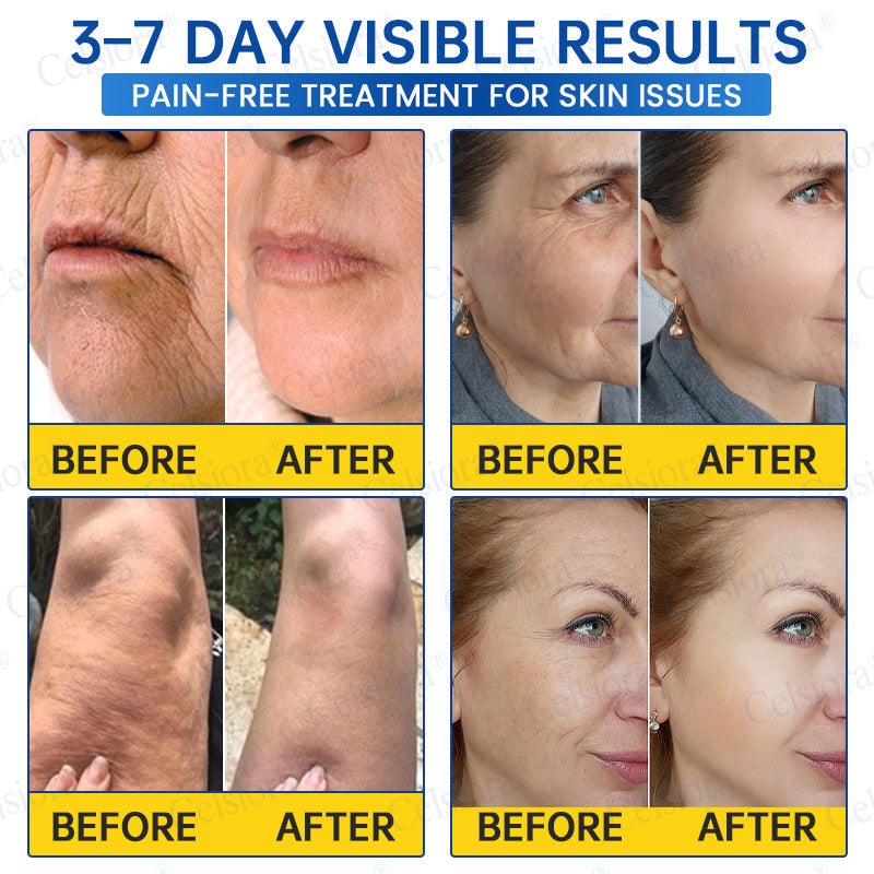 🔥👨‍⚕️USA HOT SALES💫Celsiora® Botox & PDRN Anti-Wrinkle Shot – Lift & Firming Cream