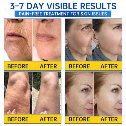 🔥👨‍⚕️USA HOT SALES💫Celsiora® Botox & PDRN Anti-Wrinkle Shot – Lift & Firming Cream