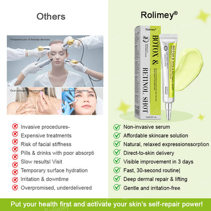 🌟Made and shipped from the USA 💫Rolimey® Botox & Vita-A Retinol Shot Wrinkle-Lift Tightening cream - Last Day Promotion 70% OFF