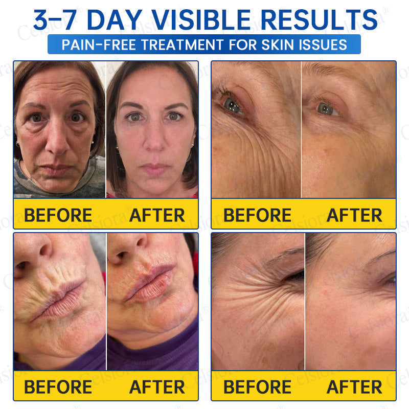 🔥👨‍⚕️USA HOT SALES💫Celsiora® Botox & PDRN Anti-Wrinkle Shot – Lift & Firming Cream