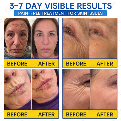 🔥👨‍⚕️USA HOT SALES💫Celsiora® Botox & PDRN Anti-Wrinkle Shot – Lift & Firming Cream