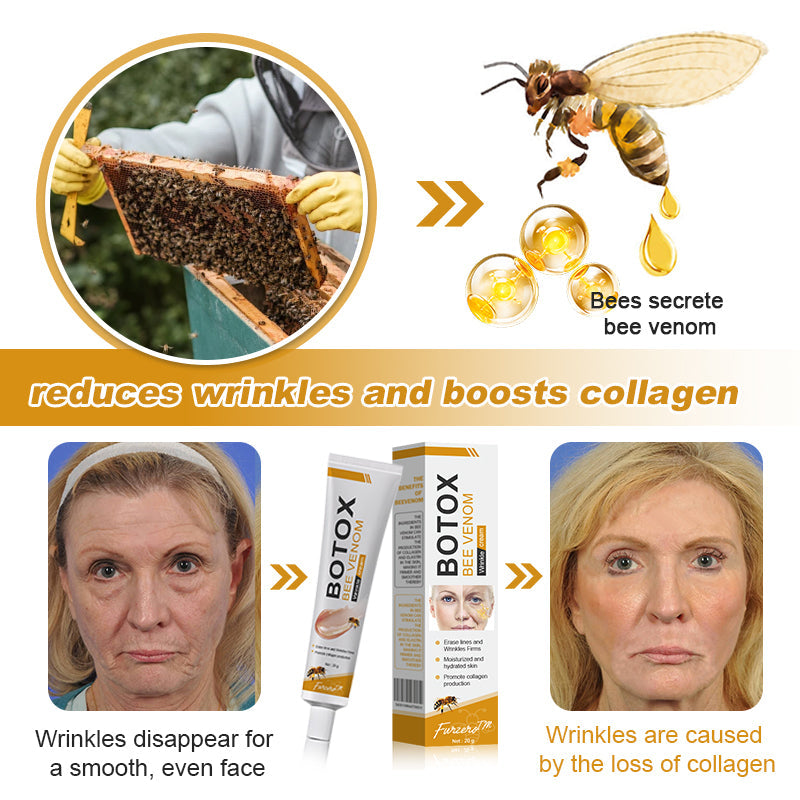 🍀👨‍⚕️Made and Shipped from the USA✅Furzero™ Botox Bee Venom Wrinkle Removal Cream-Last Day Promotion 70% OFF