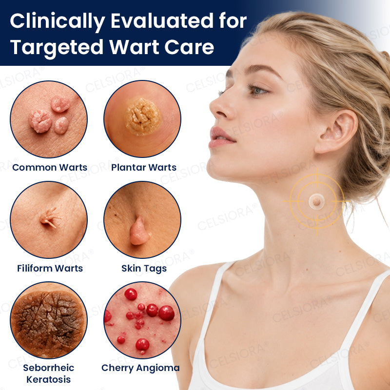 🙌🌿✨GFOUK® 7-Day MicroNeedle Wart & Skin Tag Removal Patch