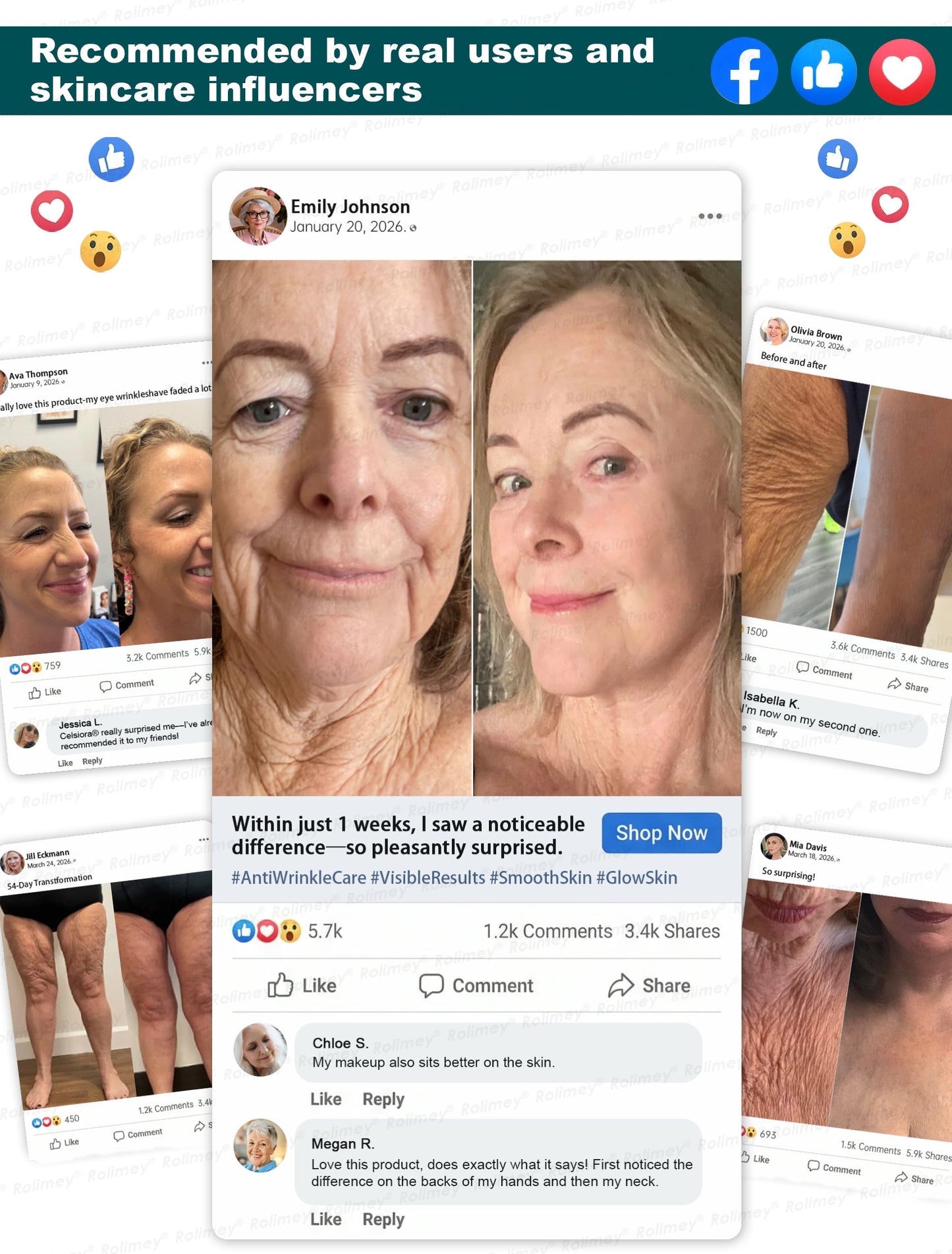 ✅USA HOT SALES ✨Rolimey® Botox & Stem Cell Wrinkle-Lift Tightening Cream