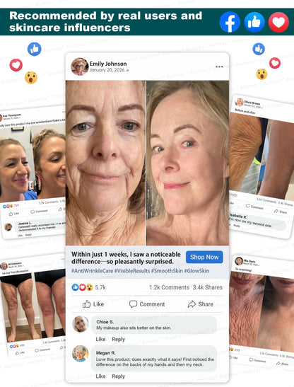 ✅USA HOT SALES ✨Rolimey® Botox & Stem Cell Wrinkle-Lift Tightening Cream