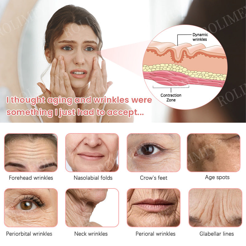 👨‍⚕️🛡️Made and Shipped from USA✅Rolimey®Botox & Stem Cell Firming Anti-Wrinkle Cream Last Day 70% OFF!