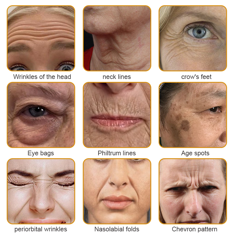 🍀👨‍⚕️Made and Shipped from the USA✅Furzero™ Botox Bee Venom Wrinkle Removal Cream-Last Day Promotion 70% OFF