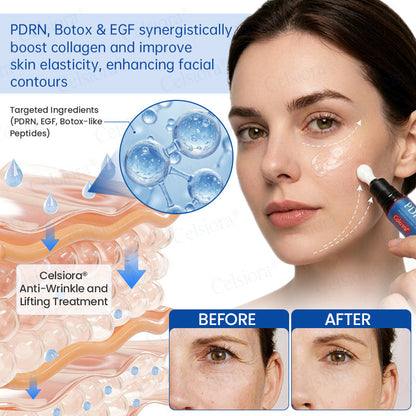 🔥👨‍⚕️USA HOT SALES💫Celsiora® Botox & PDRN Anti-Wrinkle Shot – Lift & Firming Cream