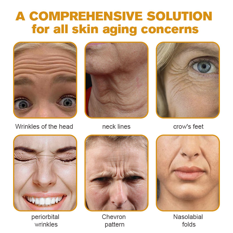 Last Day Promotion 70% OFF - ✨Furzero™ Botox Bee Venom Wrinkle Removal Cream